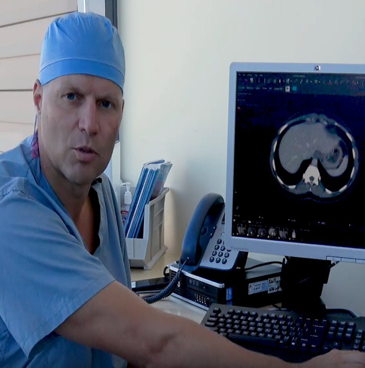 Dr. Carling undersøger omhyggeligt en CT-scanning forud for en operation med Mini Back Scope Adrenalectomy (MBSA). Dr. Carling har gennemgået tusindvis af scanninger af binyretumorer.